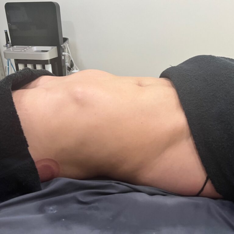 lymphatic massage in Winthrop Harbor, manual lymphatic drainage therapy, post-operative lymphatic massage