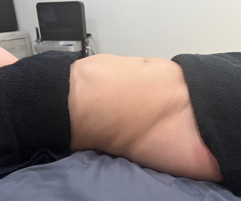 lymphatic massage in Winthrop Harbor, manual lymphatic drainage therapy, post-operative lymphatic massage