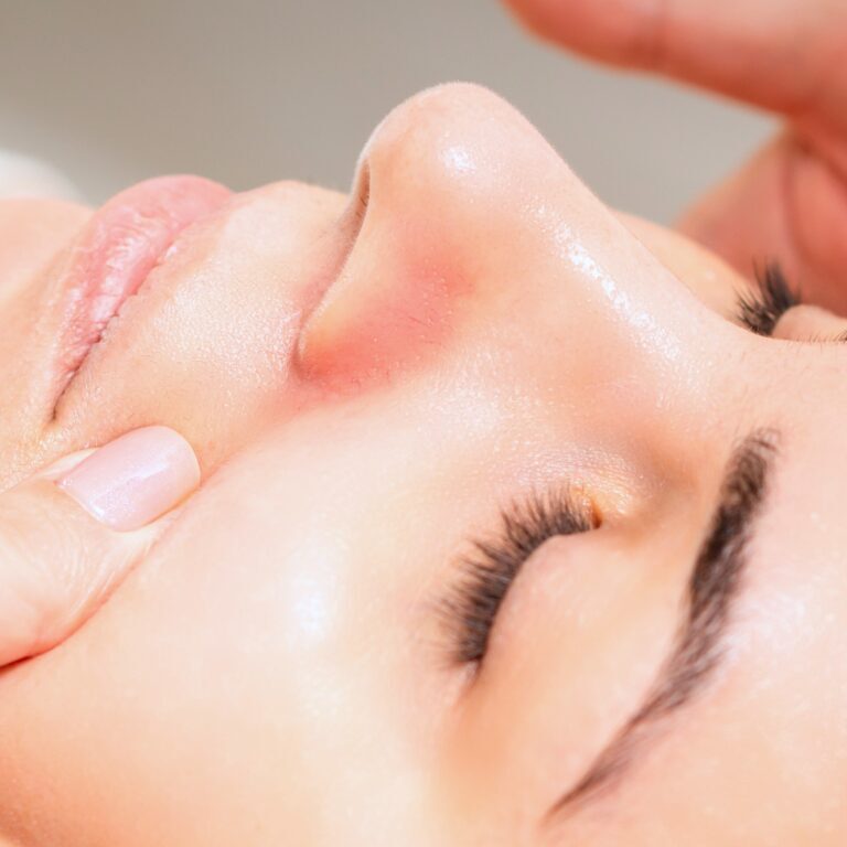 RF microneedling in Kenosha, skin tightening Kenosha, facial rejuvenation Wisconsin